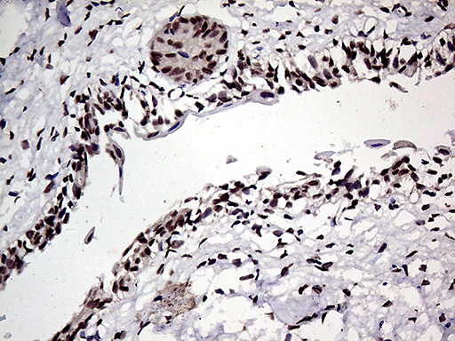 HOXD9 Antibody - Immunohistochemical staining of paraffin-embedded Human bladder tissue within the normal limits using anti-HOXD9 mouse monoclonal antibody. (Heat-induced epitope retrieval by 1mM EDTA in 10mM Tris buffer. (pH8.5) at 120°C for 3 min. (1:150)
