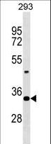 HOXD9 Antibody - Mouse Hoxd9 Antibody western blot of 293 cell line lysates (35 ug/lane). The Hoxd9 antibody detected the Hoxd9 protein (arrow).