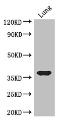 HOXD9 Antibody - Western Blot Positive WB detected in:Mouse lung tissue All Lanes: HOXD9 antibody at 3.2ug/ml Secondary Goat polyclonal to rabbit IgG at 1/50000 dilution Predicted band size: 37 kDa Observed band size: 37 kDa