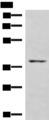 HOXD9 Antibody - Western blot analysis of NIH/3T3 cell lysate  using HOXD9 Polyclonal Antibody at dilution of 1:1000