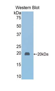 HP / Haptoglobin Antibody - Western blot of recombinant HP / Haptoglobin.  This image was taken for the unconjugated form of this product. Other forms have not been tested.