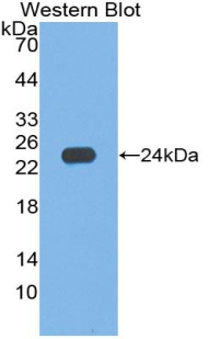 HP / Haptoglobin Antibody - Western Blot; Sample: Recombinant protein.