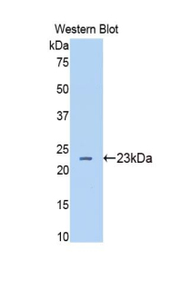 HP / Haptoglobin Antibody - Western blot of recombinant HP / Haptoglobin.  This image was taken for the unconjugated form of this product. Other forms have not been tested.