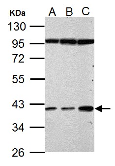 HP / Haptoglobin Antibody - Haptoglobin antibody detects Haptoglobin protein by Western blot analysis. A. 30 ug HeLa whole cell lysate/extract. B. 30 ug HepG2 whole cell lysate/extract. C. 30 ug A375 whole cell lysate/extract. 10% SDS-PAGE. Haptoglobin antibody dilution:1:500.