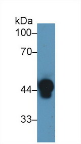 HP / Haptoglobin Antibody - Western Blot; Sample: Human Serum; Primary Ab: 1µg/ml Rabbit Anti-Human Hpt Antibody Second Ab: 0.2µg/mL HRP-Linked Caprine Anti-Rabbit IgG Polyclonal Antibody