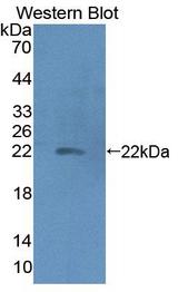 HP / Haptoglobin Antibody - Western blot of HP / Haptoglobin antibody.