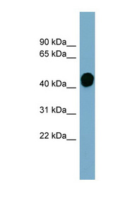 HP / Haptoglobin Antibody - HP / Haptoglobin antibody Western blot of Fetal Stomach lysate. This image was taken for the unconjugated form of this product. Other forms have not been tested.