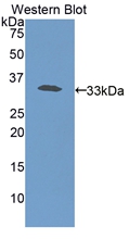 HP / Haptoglobin Antibody - Western blot of HP / Haptoglobin antibody.