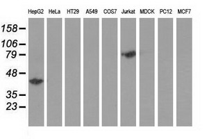 HP / Haptoglobin Antibody - Western blot of extracts (35 ug) from 9 different cell lines by using anti-HP monoclonal antibody.