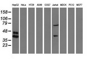 HP / Haptoglobin Antibody - Western blot analysis of extracts (35ug) from 9 different cell lines by using anti-HP monoclonal antibody.