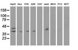 HP / Haptoglobin Antibody - Western blot of extracts (35 ug) from 9 different cell lines by using anti-HP monoclonal antibody.