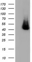 HP / Haptoglobin Antibody - HEK293T cells were transfected with the pCMV6-ENTRY control (Left lane) or pCMV6-ENTRY HP (Right lane) cDNA for 48 hrs and lysed. Equivalent amounts of cell lysates (5 ug per lane) were separated by SDS-PAGE and immunoblotted with anti-HP.