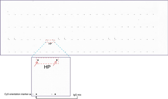 HP / Haptoglobin Antibody - OriGene overexpression protein microarray chip was immunostained with UltraMAB anti-HP mouse monoclonal antibody. (Clone UMAB10). The positive reactive proteins are highlighted with two red arrows in the enlarged subarray. All the positive controls spotted in this subarray are also labeled for clarification. These data show that UltraMAB anti-HP. (Clone UMAB10) very specifically recognizes HP antigen on OriGene protein microarray chip.