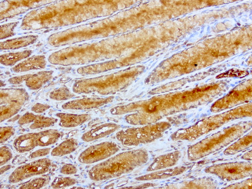 HP / Haptoglobin Antibody - Immunohistochemical staining of paraffin-embedded human gastric cancer seen mainly normal adjacent using anti-HP clone UMAB10 mouse monoclonal antibody at 1:200 with Polink2 Broad HRP DAB detection kit ; heat-induced epitope retrieval with citrate buffer, pH6.0at 95-100C. Strong cytoplasmic and membraneous staining is seen in gastric glands.