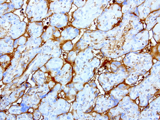 HP / Haptoglobin Antibody - Immunohistochemical staining of paraffin-embedded human placenta using anti-HP clone UMAB10 mouse monoclonal antibody at 1:200 with Polink2 Broad HRP DAB detection kit ; heat-induced epitope retrieval with citrate buffer, pH6.0at 95-100C. Strong membraneous staining is seen in placenta and adjacent blood.