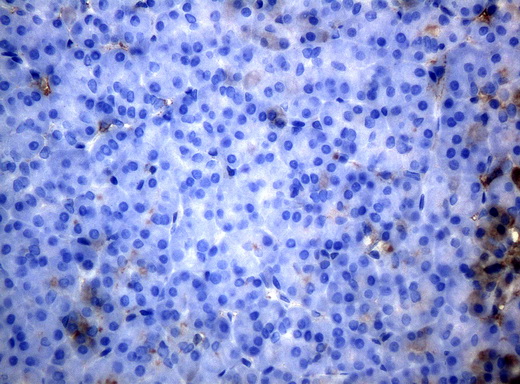 HP / Haptoglobin Antibody - Immunohistochemical staining of paraffin-embedded pancreas tissue using anti-HPmouse monoclonal antibody. (Clone UMAB10, dilution 1:100; heat-induced epitope retrieval by 10mM citric buffer, pH6.0, 120C for 3min)