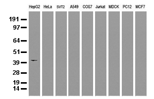 HP / Haptoglobin Antibody - Western blot analysis of extracts. (35ug) from 9 different cell lines by using anti-HP monoclonal antibody. (Clone UMAB10) at 1:500.