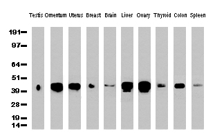 HP / Haptoglobin Antibody - Western Blot analysis of 10 different human tissue lysates. (10ug) by using anti-HP monoclonal antibody. (clone UMAB10, 1:500)