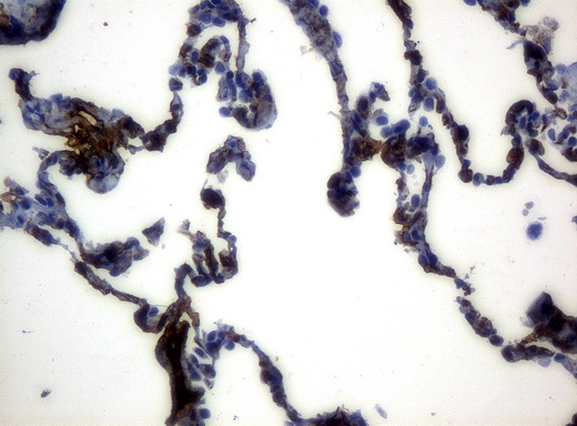 HP / Haptoglobin Antibody - Immunohistochemical staining of paraffin-embedded lung tissue using anti-HPmouse monoclonal antibody. (Clone UMAB10, dilution 1:100; heat-induced epitope retrieval by 10mM citric buffer, pH6.0, 120C for 3min)