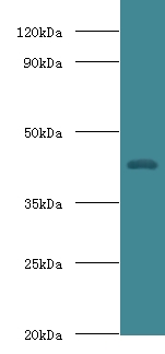 HP / Haptoglobin Antibody - Western blot of Haptoglobin antibody at 2 ug/ml with mouse stomach tissue secondary Goat polyclonal to rabbit at 1:10000 dilution predicted band size: 45 KDa observed band size: 45 KDa.  This image was taken for the unconjugated form of this product. Other forms have not been tested.