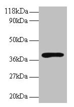 HP / Haptoglobin Antibody - Western blot All lanes: Haptoglobin antibody at 2µg/ml + Rat live tissue Secondary Goat polyclonal to rabbit IgG at 1/10000 dilution Predicted band size: 39, 43 kDa Observed band size: 39 kDa