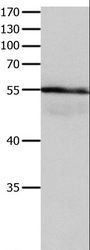 HP / Haptoglobin Antibody - Western blot analysis of Human brain gliomas tissue, using HP Polyclonal Antibody at dilution of 1:400.