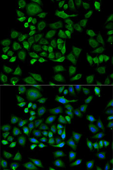 HP / Haptoglobin Antibody - Immunofluorescence analysis of HeLa cells using HP antibody. Blue: DAPI for nuclear staining.
