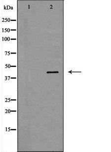 HP / Haptoglobin Antibody - Western blot analysis of HepG2 whole cells lysates using HP antibody. The lane on the left is treated with the antigen-specific peptide.