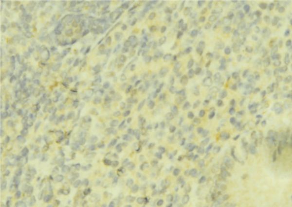 HP / Haptoglobin Antibody - 1:100 staining mouse liver tissue by IHC-P. The sample was formaldehyde fixed and a heat mediated antigen retrieval step in citrate buffer was performed. The sample was then blocked and incubated with the antibody for 1.5 hours at 22°C. An HRP conjugated goat anti-rabbit antibody was used as the secondary.