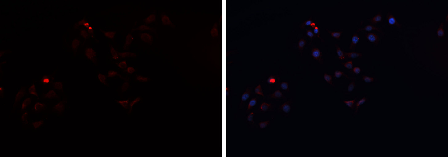 HP / Haptoglobin Antibody - Staining HepG2 cells by IF/ICC. The samples were fixed with PFA and permeabilized in 0.1% Triton X-100, then blocked in 10% serum for 45 min at 25°C. The primary antibody was diluted at 1:200 and incubated with the sample for 1 hour at 37°C. An Alexa Fluor 594 conjugated goat anti-rabbit IgG (H+L) antibody, diluted at 1/600 was used as secondary antibody.