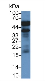 HP / Haptoglobin Antibody - Western Blot; Sample: Rat Cerebrum lysate; Primary Ab: 2µg/ml Mouse Anti-Rat a1AGP Antibody Second Ab: 0.2µg/mL HRP-Linked Caprine Anti-Mouse IgG Polyclonal Antibody