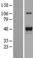 HP / Haptoglobin Protein - Western validation with an anti-DDK antibody * L: Control HEK293 lysate R: Over-expression lysate