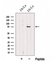 HP1BP3 Antibody - Western blot analysis of extracts of HeLa cells using HP1BP3 antibody. The lane on the left was treated with blocking peptide.
