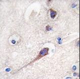 HPCA / Hippocalcin Antibody - Formalin-fixed and paraffin-embedded human brain tissue reacted with Hippocalcin antibody , which was peroxidase-conjugated to the secondary antibody, followed by DAB staining. This data demonstrates the use of this antibody for immunohistochemistry; clinical relevance has not been evaluated.
