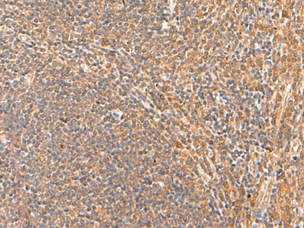 HPCA / Hippocalcin Antibody - Immunohistochemistry of paraffin-embedded Human tonsil tissue  using HPCA Polyclonal Antibody at dilution of 1:55(×200)