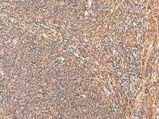 HPCA / Hippocalcin Antibody - Immunohistochemistry of paraffin-embedded Human tonsil tissue  using HPCA Polyclonal Antibody at dilution of 1:55(×200)