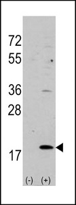 HPCAL1 / Hippocalcin-Like 1 Antibody - Western blot of VILIP3 (arrow) using rabbit polyclonal VILIP3 Antibody. 293 cell lysates (2 ug/lane) either nontransfected (Lane 1) or transiently transfected with the VILIP3 gene (Lane 2) (Origene Technologies).