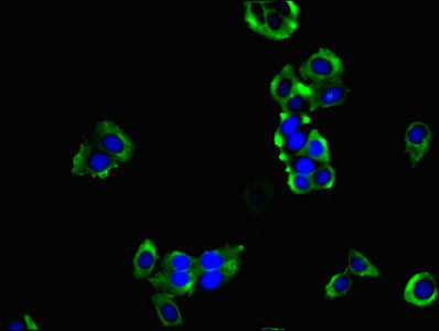 HPCAL1 / Hippocalcin-Like 1 Antibody - Immunofluorescent analysis of PC-3 cells using HPCAL1 Antibody at dilution of 1:100 and Alexa Fluor 488-congugated AffiniPure Goat Anti-Rabbit IgG(H+L)