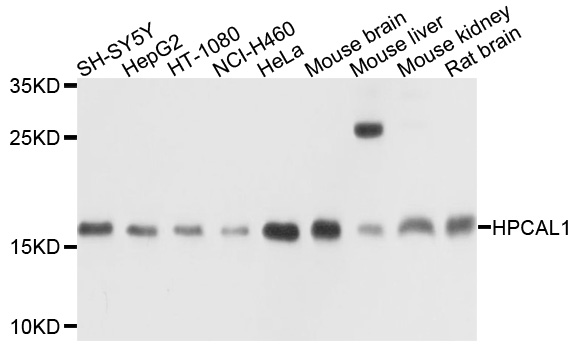 HPCAL1 / Hippocalcin-Like 1 Antibody - Western blot analysis of extracts of various cell lines, using HPCAL1 antibody at 1:1000 dilution. The secondary antibody used was an HRP Goat Anti-Rabbit IgG (H+L) at 1:10000 dilution. Lysates were loaded 25ug per lane and 3% nonfat dry milk in TBST was used for blocking. An ECL Kit was used for detection and the exposure time was 30s.