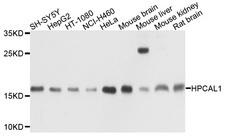 HPCAL1 / Hippocalcin-Like 1 Antibody - Western blot analysis of extracts of various cell lines, using HPCAL1 antibody at 1:1000 dilution. The secondary antibody used was an HRP Goat Anti-Rabbit IgG (H+L) at 1:10000 dilution. Lysates were loaded 25ug per lane and 3% nonfat dry milk in TBST was used for blocking. An ECL Kit was used for detection and the exposure time was 30s.
