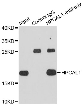 HPCAL1 / Hippocalcin-Like 1 Antibody - Immunoprecipitation analysis of extracts of HepG2 cells using HPCAL1 antibody. Western blot was performed from the immunoprecipitate using HPCAL1 antibodyat a dilition of 1:1000.