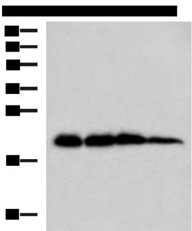 HPCAL1 / Hippocalcin-Like 1 Antibody - Western blot analysis of Rat brain tissue Hela HepG2 and A172 cell lysates  using HPCAL1 Polyclonal Antibody at dilution of 1:1000