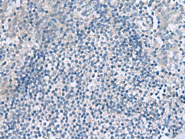 HPCAL1 / Hippocalcin-Like 1 Antibody - Immunohistochemistry of paraffin-embedded Human tonsil tissue  using HPCAL1 Polyclonal Antibody at dilution of 1:90(×200)