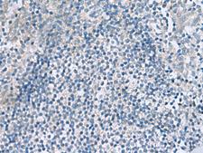 HPCAL1 / Hippocalcin-Like 1 Antibody - Immunohistochemistry of paraffin-embedded Human tonsil tissue  using HPCAL1 Polyclonal Antibody at dilution of 1:90(×200)