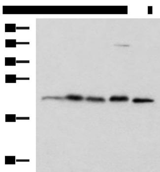 HPCAL1 / Hippocalcin-Like 1 Antibody - Western blot analysis of A172 HepG2 Hela cell Rat brain tissue and Mouse brain tissue lysates  using HPCAL1 Polyclonal Antibody at dilution of 1:1250