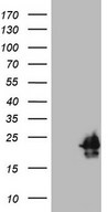 HPCAL4 Antibody - HEK293T cells were transfected with the pCMV6-ENTRY control. (Left lane) or pCMV6-ENTRY HPCAL4. (Right lane) cDNA for 48 hrs and lysed. Equivalent amounts of cell lysates. (5 ug per lane) were separated by SDS-PAGE and immunoblotted with anti-HPCAL4. (1:2000)