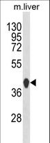 HPD Antibody - Western blot of HPD Antibody in mouse liver tissue lysates (35 ug/lane). HPD (arrow) was detected using the purified antibody.
