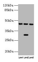 HPD Antibody - Western blot All lanes: HPD antibody at 4.5µg/ml Lane 1: Mouse kidney tissue Lane 2: Mouse liver tissue Lane 3: HepG2 whole cell lysate Secondary Goat polyclonal to rabbit IgG at 1/10000 dilution Predicted band size: 45, 41 kDa Observed band size: 45, 31 kDa