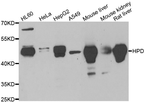 HPD Antibody - Western blot analysis of extracts of various cell lines.