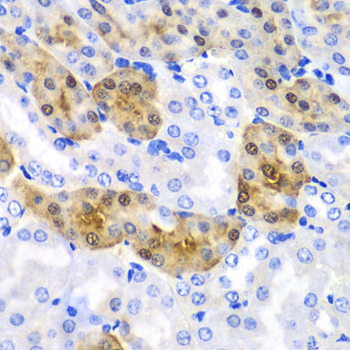 HPD Antibody - Immunohistochemistry of paraffin-embedded mouse kidney tissue.